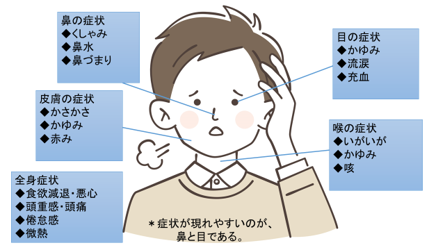 花粉症の症状